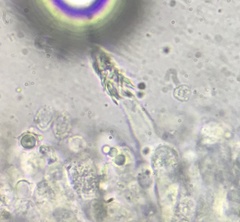 Melanoleuca polioleuca