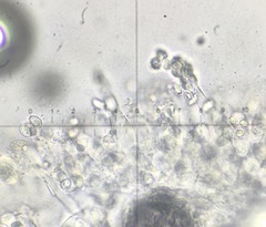 Melanoleuca polioleuca