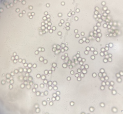 Lacrymaria lacrymabunda