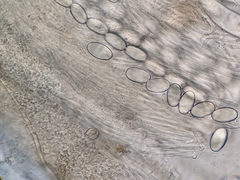 Lasiobolus intermedius