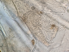 Lasiobolus intermedius