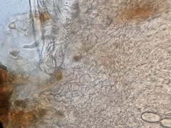 Lasiobolus intermedius