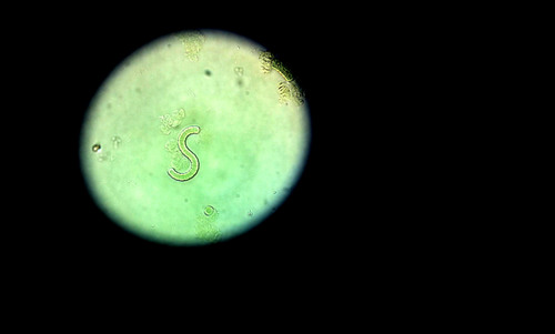 Spirulina (Arthrospira platensis)