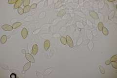 Botryobasidium aureum