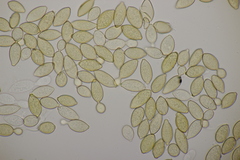 Botryobasidium aureum