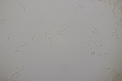 Botryobasidium aureum