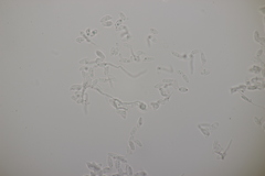 Botryobasidium aureum