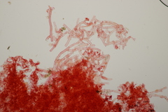 Botryobasidium aureum