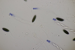 Rosellinia