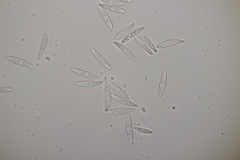 Ascocoryne cylichnium
