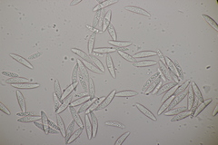 Ascocoryne cylichnium