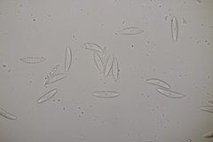 Ascocoryne cylichnium