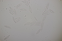 Ascocoryne cylichnium