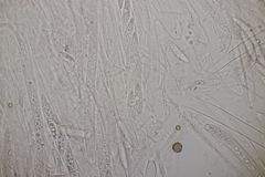 Ascocoryne cylichnium