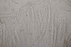 Ascocoryne cylichnium