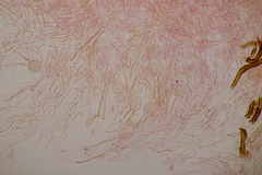Myxarium nucleatum