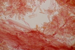 Calyptella campanula