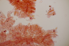 Calyptella campanula