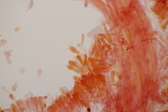 Calyptella campanula