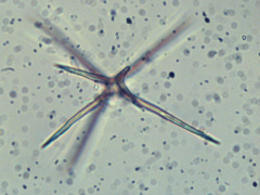 Asterostroma cervicolor