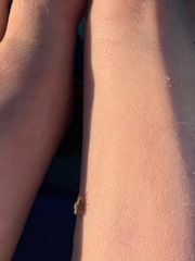 Diptera