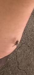 Diptera