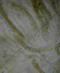 Phaeosphaeria viridella