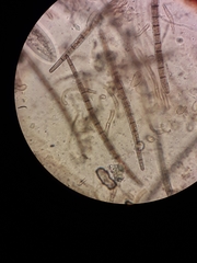 Trichoglossum hirsutum