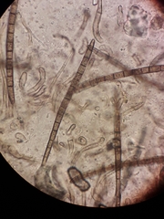 Trichoglossum hirsutum