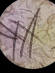 Trichoglossum hirsutum