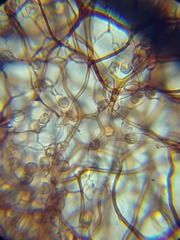 Stemonitopsis hyperopta