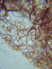 Stemonitopsis hyperopta