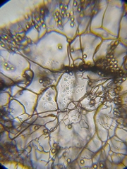 Stemonitopsis hyperopta