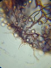 Stemonitopsis hyperopta