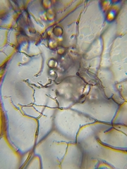 Stemonitopsis hyperopta