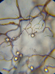 Stemonitopsis hyperopta