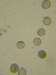 Stemonitopsis hyperopta