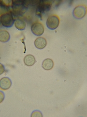 Stemonitopsis hyperopta