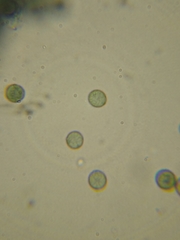 Stemonitopsis hyperopta