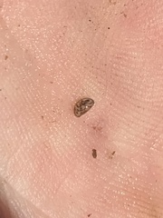Chlamydotheca arcuata