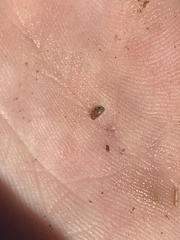 Chlamydotheca arcuata