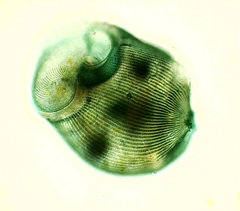 Stentor coeruleus