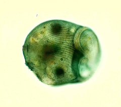 Stentor coeruleus