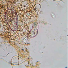 Cephalodella gibboides