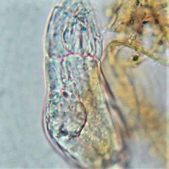 Cephalodella gibboides