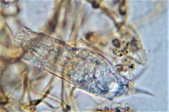 Cephalodella gibboides