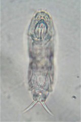 Cephalodella gibboides