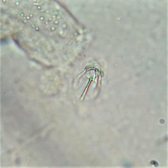 Cephalodella gibboides