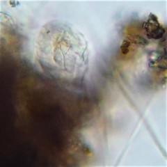 Cephalodella gibboides