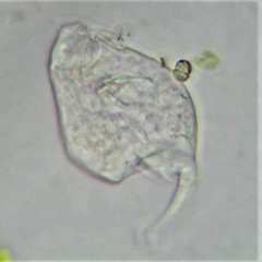 Cephalodella gibboides